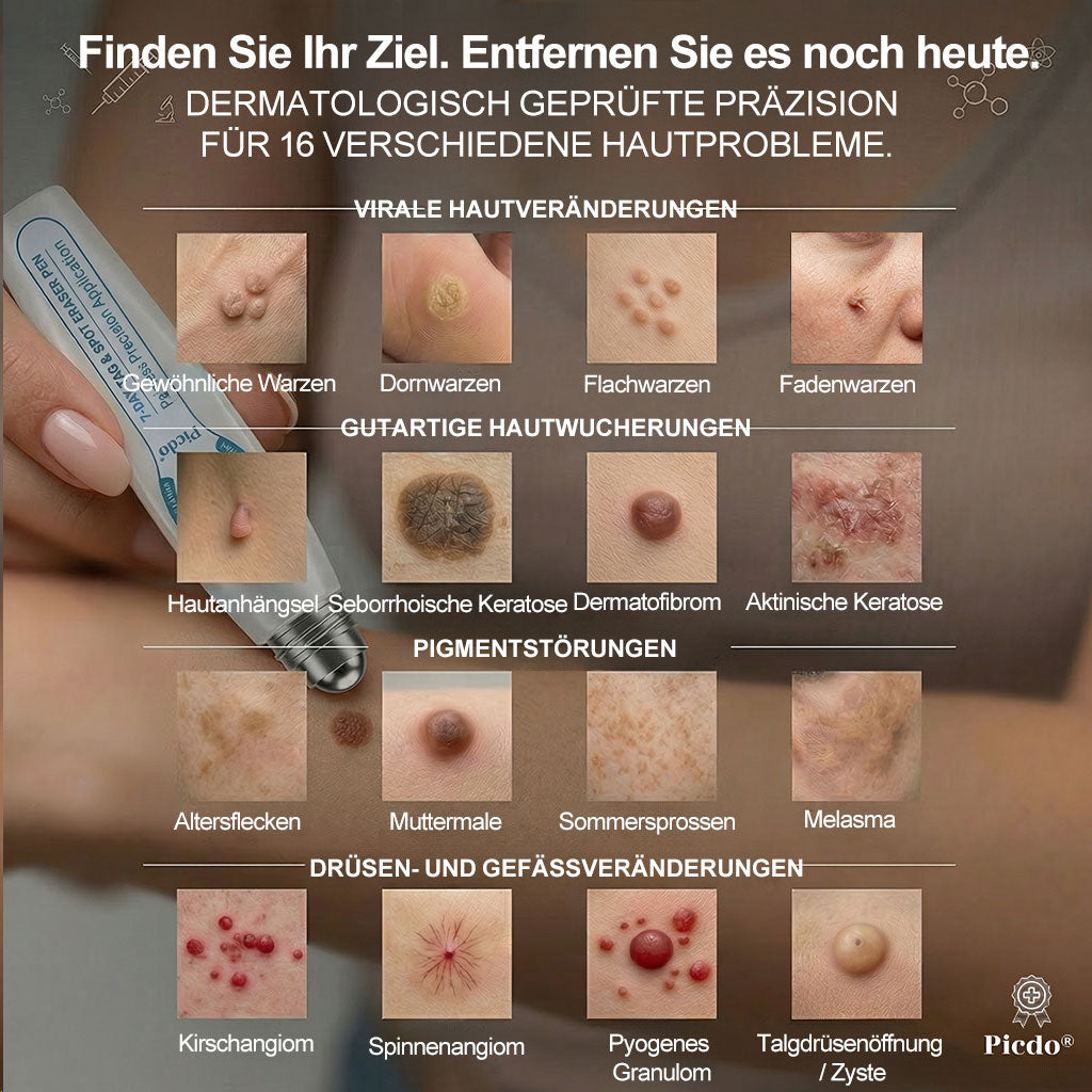 ✨🎇Offizieller Markenstore |✅𝑷𝑖𝒄𝐝𝐨® 7-𝑻𝒂𝒈𝒆 𝑯𝒂𝒖𝒕𝒂𝒏𝒉ä𝒏𝒈𝒔𝒆𝒍- & 𝑭𝒍𝒆𝒄𝒌𝒆𝒏𝒆𝒏𝒕𝒇𝒆𝒓𝒏𝒆𝒓(Schmerzfreier Rollerball – Keine Narbenbildung)🚀