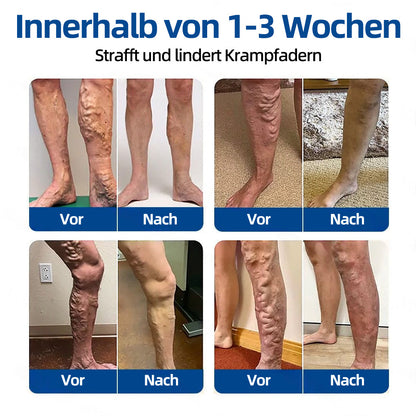 ✨👍 𝐅𝐥𝐨𝐫𝐢𝐬𝐦𝐚® 𝑲𝒍𝒊𝒏𝒊𝒔𝒄𝒉𝒆𝒔 𝑴𝒊𝒄𝒓𝒐𝒏𝒆𝒆𝒅𝒍𝒆‑𝑷𝒇𝒍𝒂𝒔𝒕𝒆𝒓 𝒎𝒊𝒕 𝑫𝒊𝒐𝒔𝒎𝒊𝒏 & 𝑯𝒆𝒔𝒑𝒆𝒓𝒊𝒅𝒊𝒏 — Eine fortschrittliche pflanzliche Wirkstoffkombination zur gezielten Unterstützung bei Besenreisern und Krampfadern sowie zur Linderung von schweren und müden Beinen.👩‍⚕️