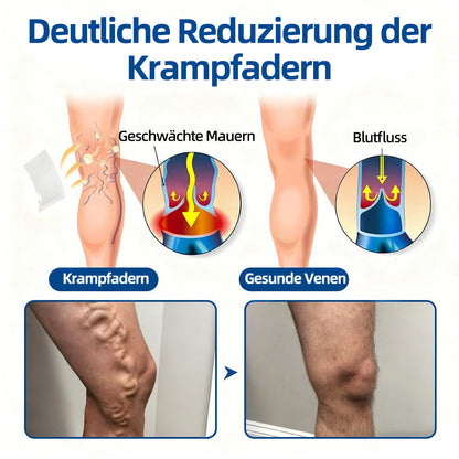 ✨👍 𝐅𝐥𝐨𝐫𝐢𝐬𝐦𝐚® 𝑲𝒍𝒊𝒏𝒊𝒔𝒄𝒉𝒆𝒔 𝑴𝒊𝒄𝒓𝒐𝒏𝒆𝒆𝒅𝒍𝒆‑𝑷𝒇𝒍𝒂𝒔𝒕𝒆𝒓 𝒎𝒊𝒕 𝑫𝒊𝒐𝒔𝒎𝒊𝒏 & 𝑯𝒆𝒔𝒑𝒆𝒓𝒊𝒅𝒊𝒏 — Eine fortschrittliche pflanzliche Wirkstoffkombination zur gezielten Unterstützung bei Besenreisern und Krampfadern sowie zur Linderung von schweren und müden Beinen.👩‍⚕️
