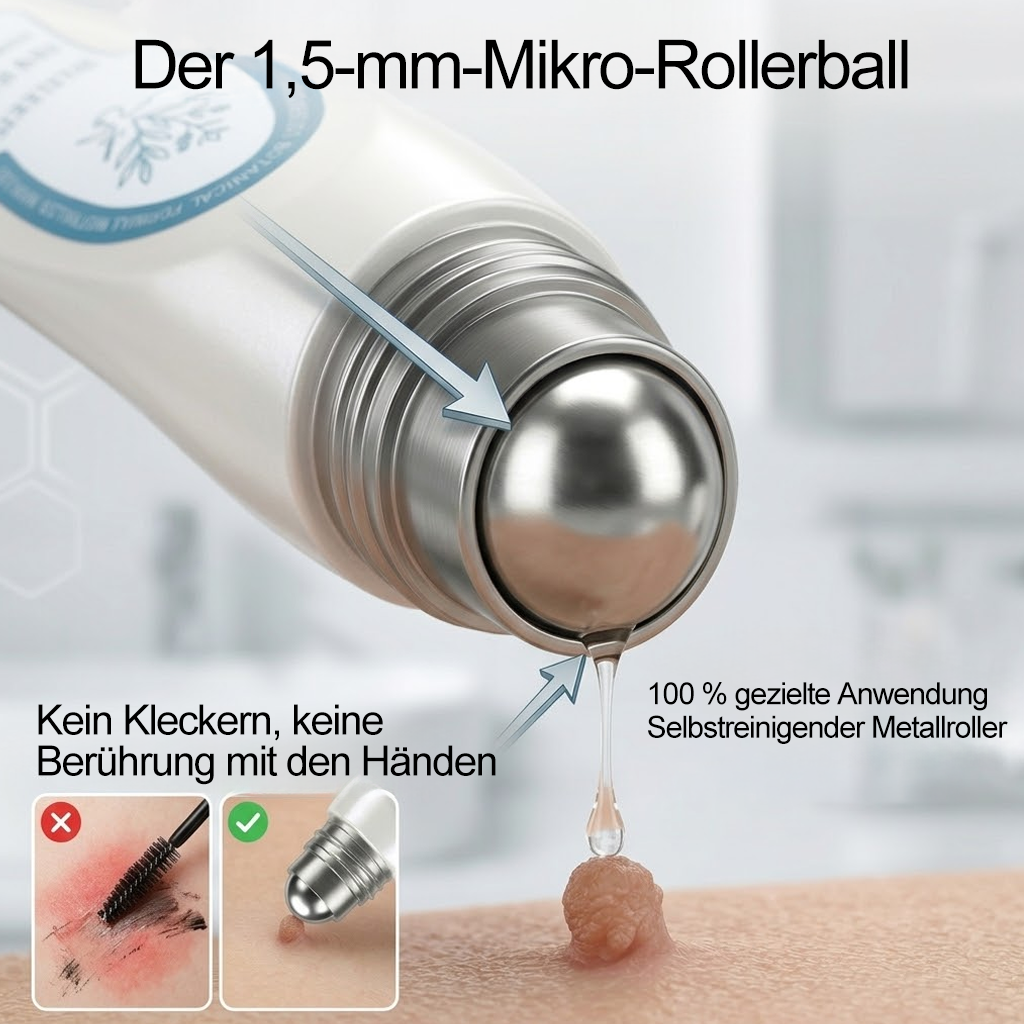 ✨🎇Offizieller Markenstore |✅𝑷𝑖𝒄𝐝𝐨® 7-𝑻𝒂𝒈𝒆 𝑯𝒂𝒖𝒕𝒂𝒏𝒉ä𝒏𝒈𝒔𝒆𝒍- & 𝑭𝒍𝒆𝒄𝒌𝒆𝒏𝒆𝒏𝒕𝒇𝒆𝒓𝒏𝒆𝒓(Schmerzfreier Rollerball – Keine Narbenbildung)🚀