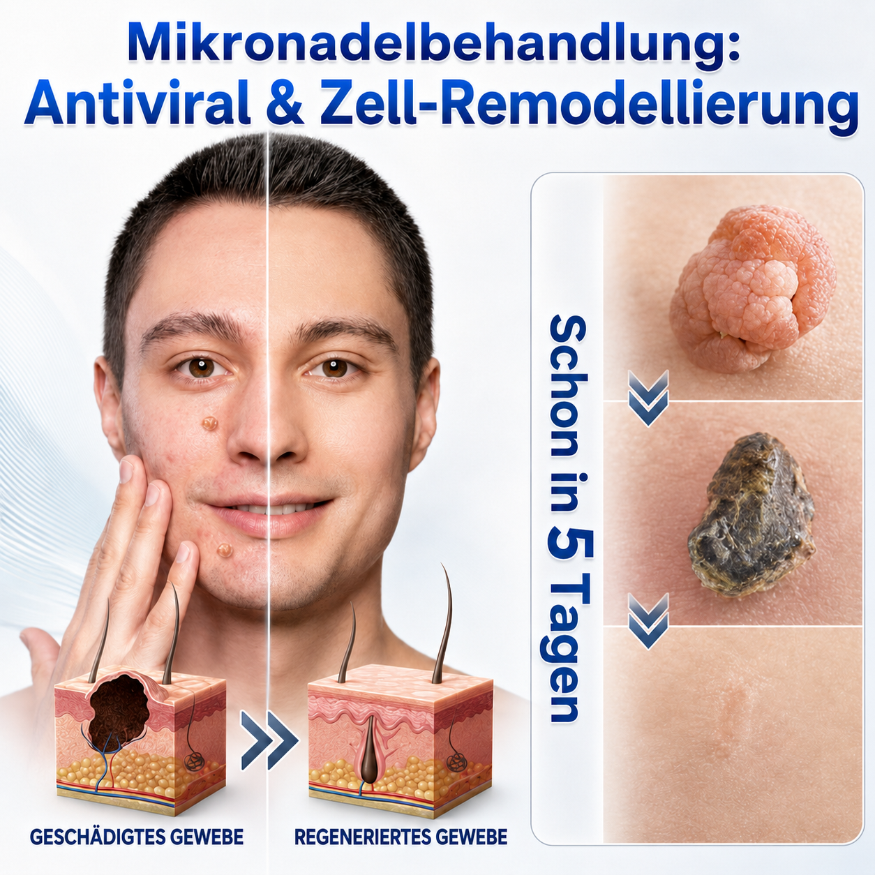 💧💧 𝑶𝒇𝒇𝒊𝒛𝒊𝒆𝒍𝒍𝒆𝒓 𝑺𝒕𝒐𝒓𝒆 | 𝑵𝐞𝒌𝐢𝐬𝐬® 🌿 𝑴𝒊𝒌𝒓𝒐𝒏𝒂𝒅𝒆𝒍𝒏 𝑴𝒂𝒌𝒆𝒍𝒍𝒐𝒔𝒆 𝑯𝒂𝒖𝒕 𝑯𝒂𝒖𝒕 𝑾𝒂𝒓𝒛𝒆 𝑬𝒏𝒕𝒇𝒆𝒓𝒏𝒖𝒏𝒈 𝑷𝒇𝒍𝒂𝒔𝒕𝒆𝒓 (𝐹ü𝑟 𝐻𝑎𝑢𝑡𝑎𝑛ℎä𝑛𝑔𝑠𝑒𝑙, 𝑘𝑙𝑒𝑖𝑛𝑒 𝐻𝑎𝑢𝑡𝑤𝑢𝑐ℎ𝑒𝑟𝑢𝑛𝑔𝑒𝑛, 𝑊𝑎𝑟𝑧𝑒𝑛, 𝑀𝑢𝑡𝑡𝑒𝑟𝑚𝑎𝑙𝑒, 𝐴𝑙𝑡𝑒𝑟𝑠𝑓𝑙𝑒𝑐𝑘𝑒𝑛 𝑢𝑛𝑑 𝑃𝑖𝑔𝑚𝑒𝑛𝑡𝑠𝑡ö𝑟𝑢𝑛𝑔𝑒𝑛.)