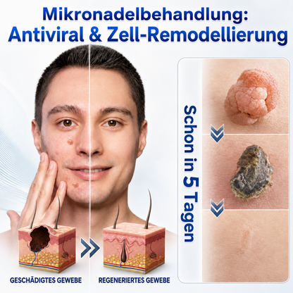 💧💧 𝑶𝒇𝒇𝒊𝒛𝒊𝒆𝒍𝒍𝒆𝒓 𝑺𝒕𝒐𝒓𝒆 | 𝑵𝐞𝒌𝐢𝐬𝐬® 🌿 𝑴𝒊𝒌𝒓𝒐𝒏𝒂𝒅𝒆𝒍𝒏 𝑴𝒂𝒌𝒆𝒍𝒍𝒐𝒔𝒆 𝑯𝒂𝒖𝒕 𝑯𝒂𝒖𝒕 𝑾𝒂𝒓𝒛𝒆 𝑬𝒏𝒕𝒇𝒆𝒓𝒏𝒖𝒏𝒈 𝑷𝒇𝒍𝒂𝒔𝒕𝒆𝒓 (𝐹ü𝑟 𝐻𝑎𝑢𝑡𝑎𝑛ℎä𝑛𝑔𝑠𝑒𝑙, 𝑘𝑙𝑒𝑖𝑛𝑒 𝐻𝑎𝑢𝑡𝑤𝑢𝑐ℎ𝑒𝑟𝑢𝑛𝑔𝑒𝑛, 𝑊𝑎𝑟𝑧𝑒𝑛, 𝑀𝑢𝑡𝑡𝑒𝑟𝑚𝑎𝑙𝑒, 𝐴𝑙𝑡𝑒𝑟𝑠𝑓𝑙𝑒𝑐𝑘𝑒𝑛 𝑢𝑛𝑑 𝑃𝑖𝑔𝑚𝑒𝑛𝑡𝑠𝑡ö𝑟𝑢𝑛𝑔𝑒𝑛.)